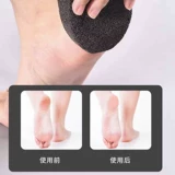 Вулканический камень шлифований стоп, чтобы потирать кожу, потирая ногу, ноги, ноги, двойные к мозоли, нога ног измельчение артефакта