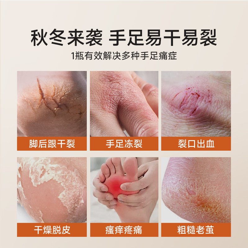 脚后跟干裂修复霜专治脚底皲裂开裂起硬皮脱皮防手护足裂口马油膏,淘宝优惠券,粉丝福利购,淘宝优惠卷