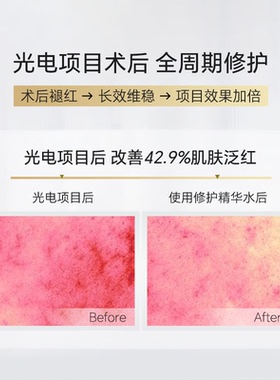 铂鱼高浓度PDRN修护保湿补水喷雾