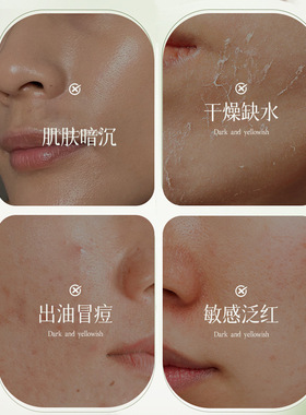 【梦玲同款】净研控油收敛精华乳