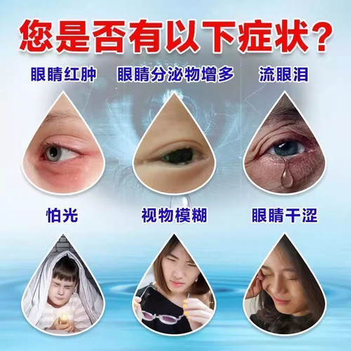 怕光流泪结膜炎眼干涩发红疼痛眼睛痒眼睛模糊眼屎多龙泽熊胆胶囊 - 图0