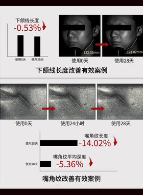 ProtYouth单一成分重组胶原液
