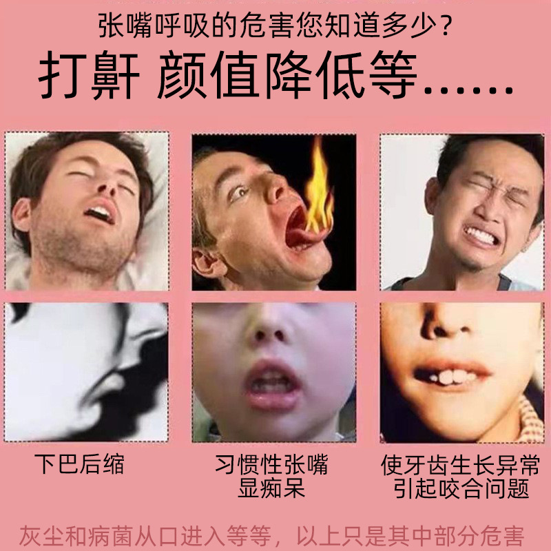 口呼吸矫正器睡觉防张嘴闭嘴神器儿童张口防止用嘴巴打呼噜止鼾带-图2