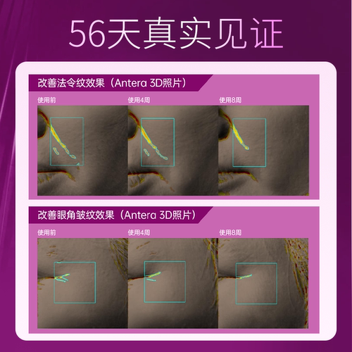 3桶装-losoki胶原蛋白肽乐斯可燕窝肽粉燕窝酸眼纹垮脸原装进口 - 图1