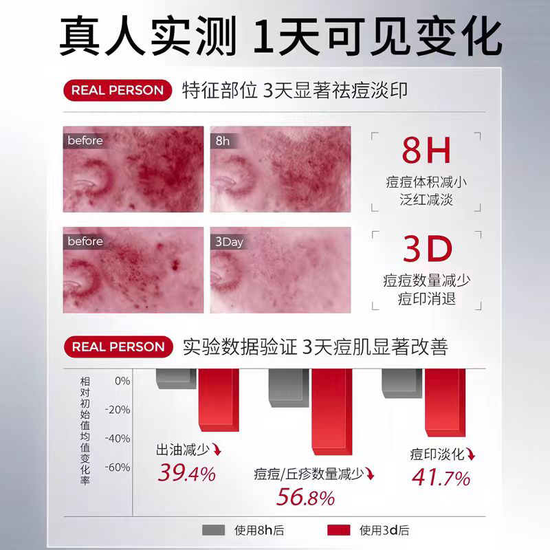 祛痘印黑色素沉淀去痘坑水痘疤痕修复男女生消淡印炎却痘痘医用wg