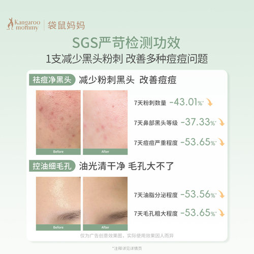 袋鼠妈妈青少年洁面乳控油祛痘男女孩青春期专用去黑头洗面奶30g - 图0