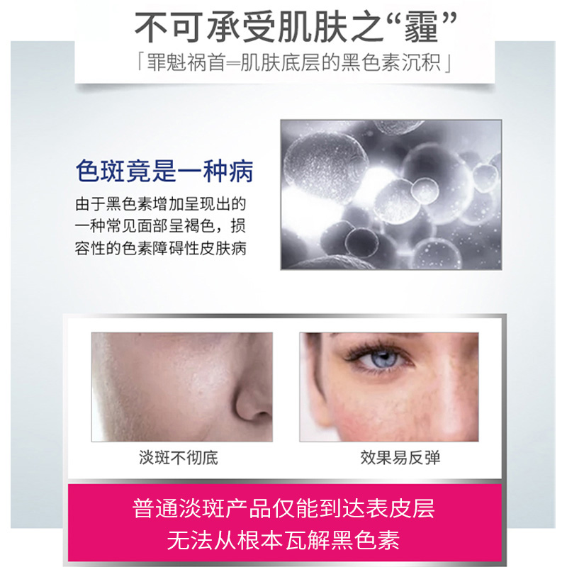 帕玛氏焕白淡斑洁面皂100g*3只 淡化瑕疵嫩滑肌肤亮白匀肤温和