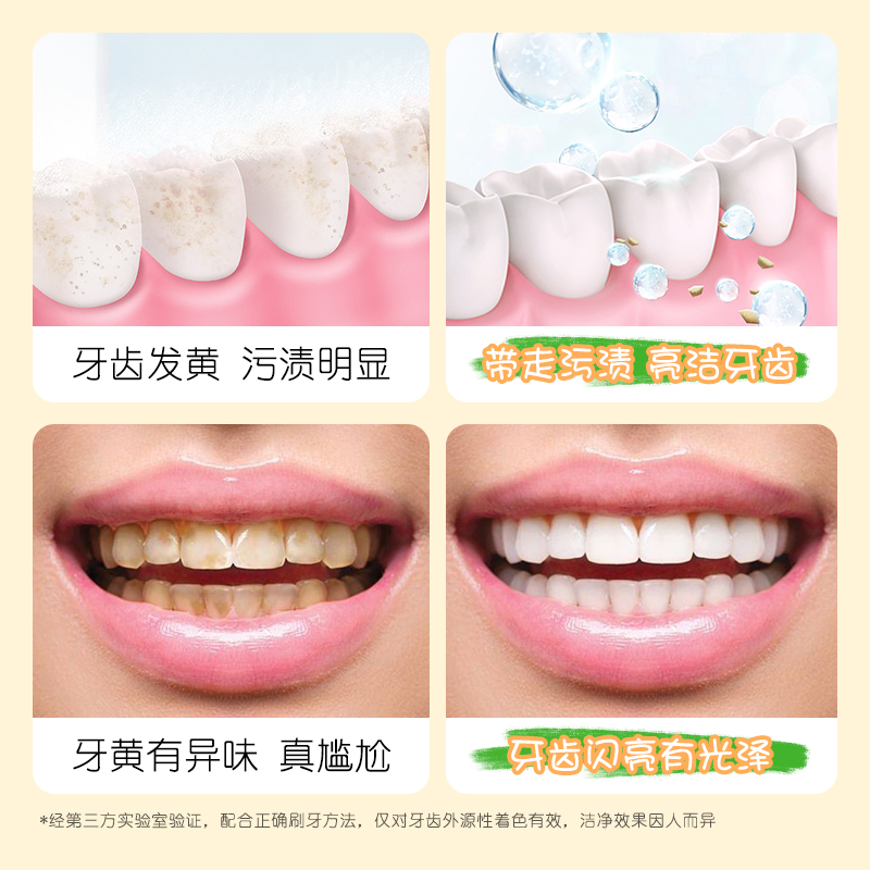 兰诗哲清新舒护牙膏清洁异味保护牙齿清新口气家庭款A