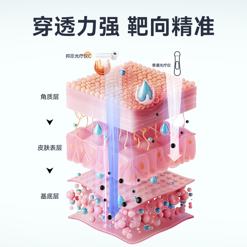 邦臣308光疗仪白癜风家用nm准分子紫外线治疗仪医用激光UV-308D-图2