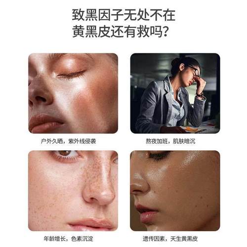 CGN美国加州黄金S乙酰L谷胱甘肽胶囊内服美白丸细胞健康透亮肌肤 - 图3