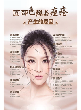 色斑反射图海报展板面部色斑与痤疮的产生分析图墙贴纸KT板墙纸