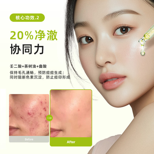 PURITO壬二酸10%茶树精华祛痘精华液敏感肌温和祛痘控油修护女 - 图2