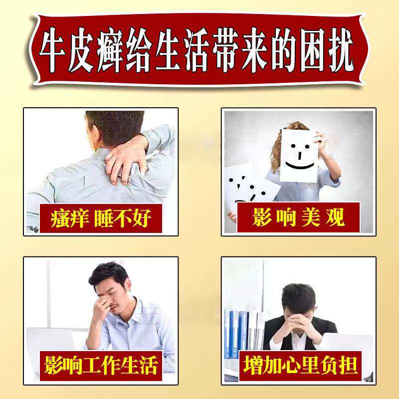  懩生宝大药房癣症
