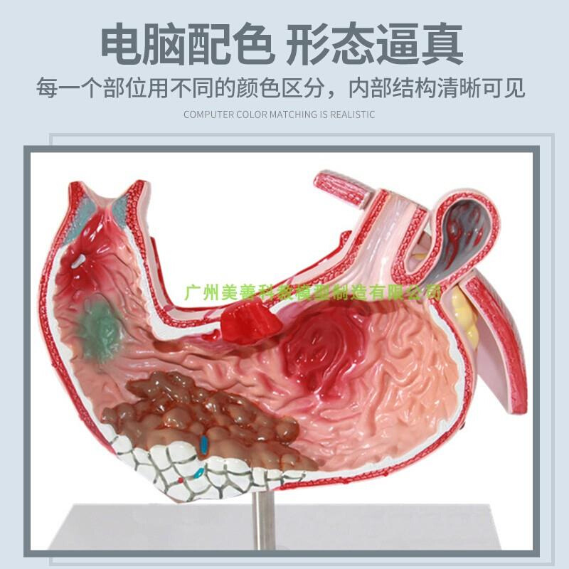 胃解剖结构模型自然大胃模型人体G消化系统器官医学解剖模-图1