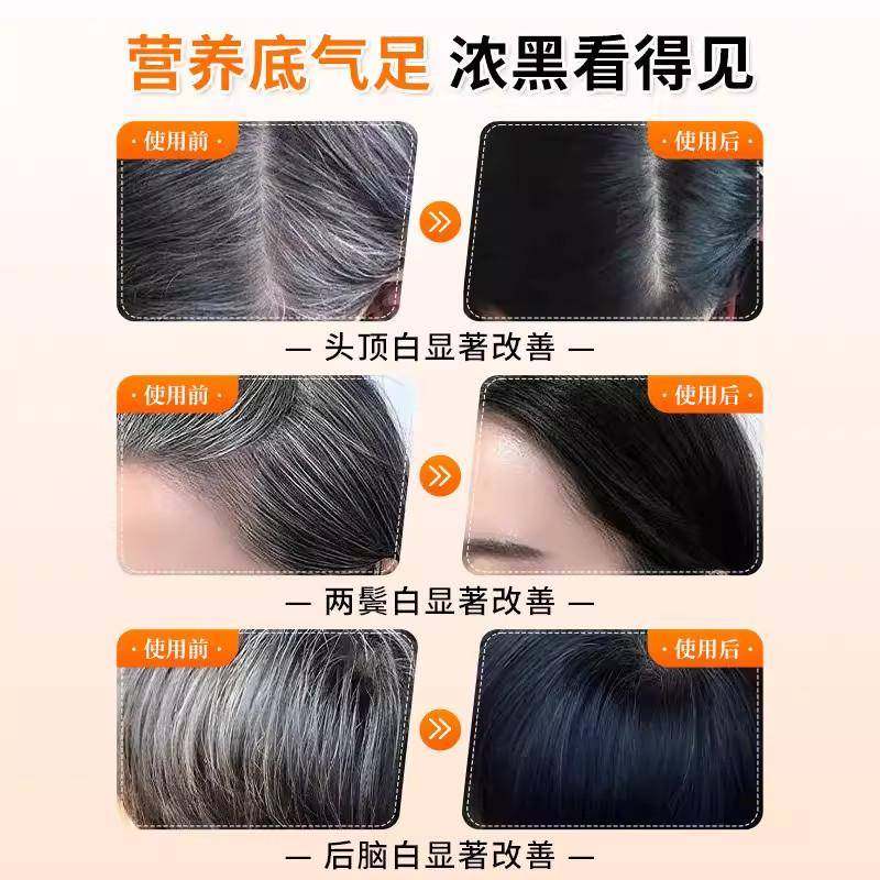 卡西奈维生素b维生素d3白发脱发生物素黑发养发男女,淘宝优惠券,粉丝福利购,淘宝优惠卷