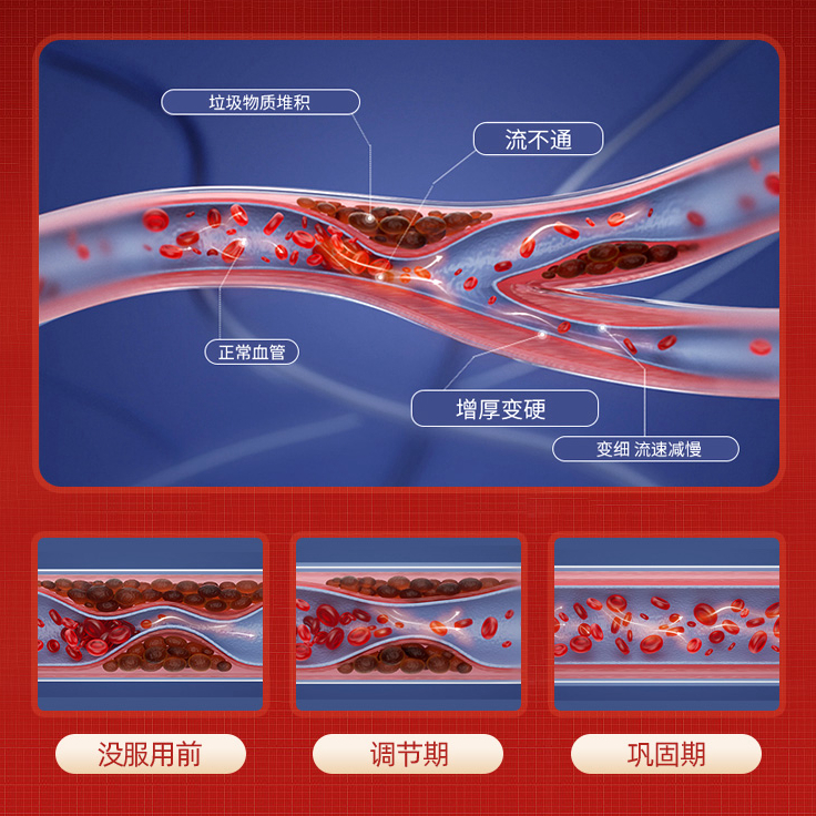 澳洲原装CareMagic水蛭素小分子肽72000ATU呵护心脑血管中老年-图2