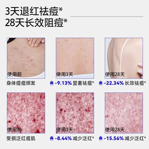EHD沐浴露祛痘持久除留香72小时香水男女士水杨酸螨乳液官方品牌 - 图0