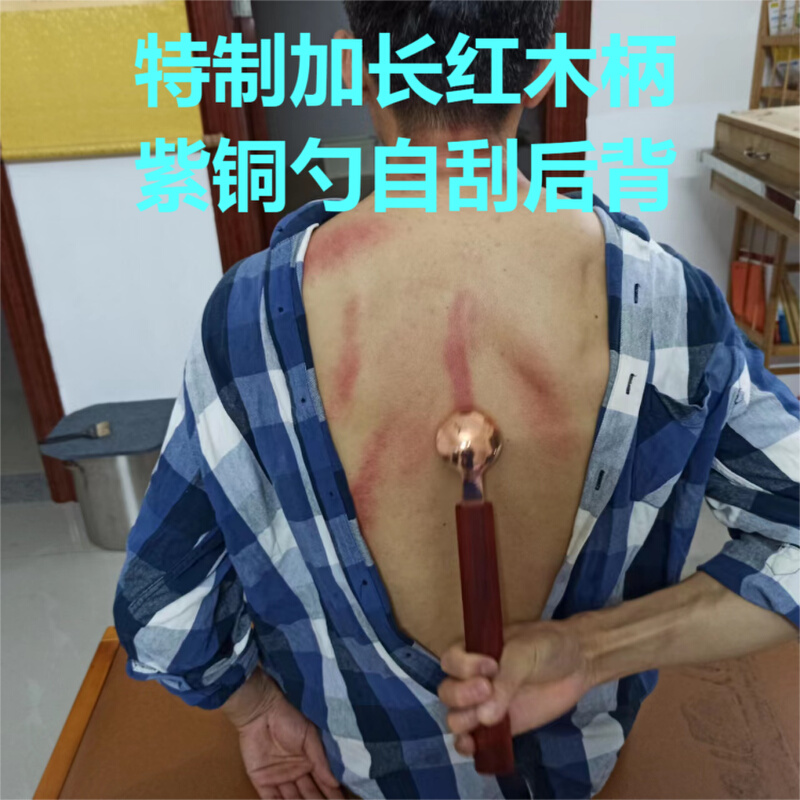 九壮艾瘦脸刮痧勺擀筋棒板按摩推拿紫铜黄铜杨大庆李氏砭法理筋刀 - 图2