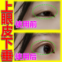 Prevention of upper eyesdrop sagging with double eyelid Pediatry Eyelid Relaxation Eyelid Anti-Slackness Special Sticker