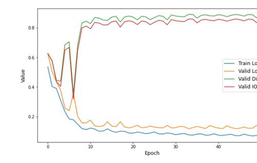 基于深度学习UNet医学病灶检测肠胃道图像分割完整数据集python-图2