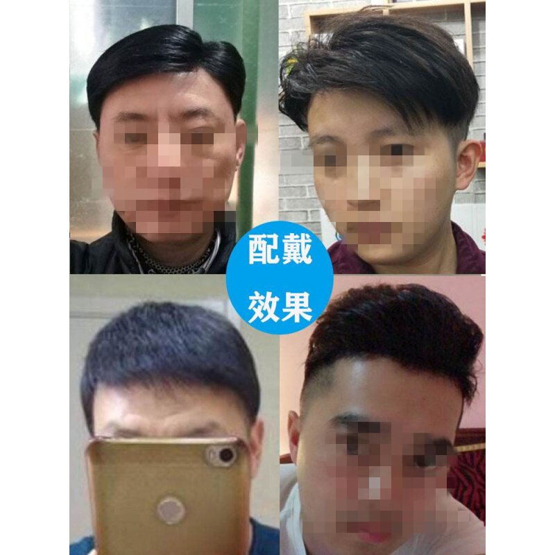 假发男头顶补发男真发短发帅气织发补发片男士秃顶前额发际线隐形 - 图3