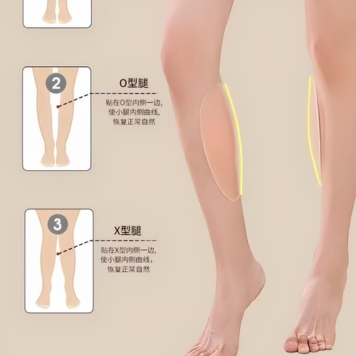 修饰腿型硅胶贴变直腿速矫正罗圈腿小腿外翻贴变直腿型弥补凹陷 - 图0