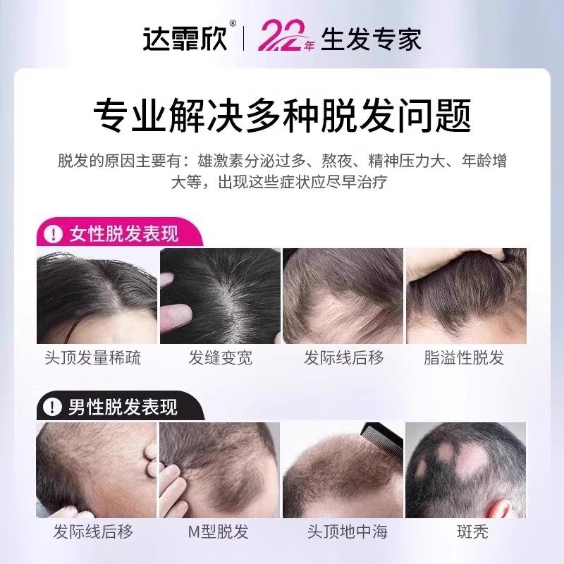 达霏欣米诺地尔搽剂2%女士生发液白发脱发发际线增长液,淘宝优惠券,粉丝福利购,淘宝优惠卷