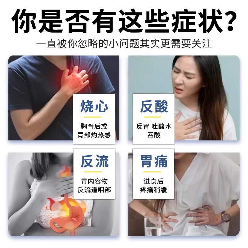 奥美拉唑肠溶胶囊正品胃药胃酸过多反酸烧心胃不舒服胃炎专用药
