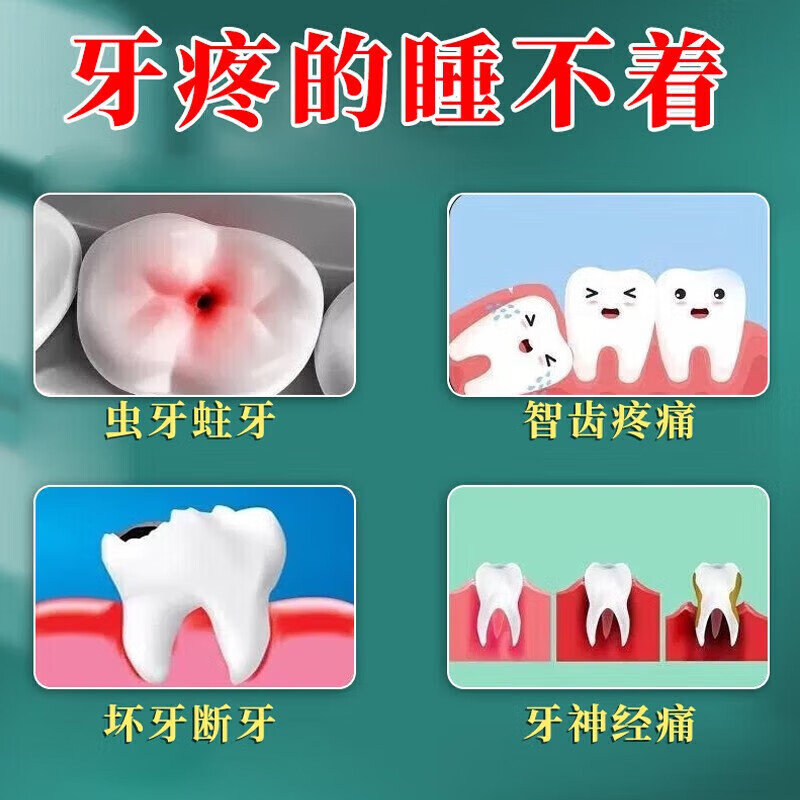 丁硼乳膏正品牙痛智齿牙疼消炎牙龈肿痛消炎药牙龈炎牙周炎口腔炎