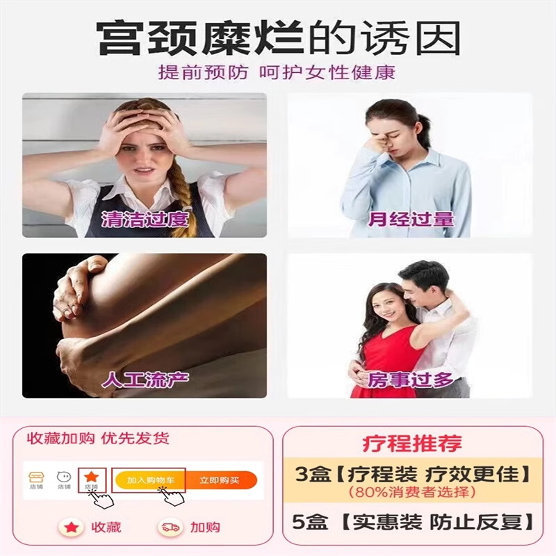 消糜栓 阴道炎妇科用药宫颈糜烂用药 治疗宫颈炎的药白带腥臭瘙痒 - 图2