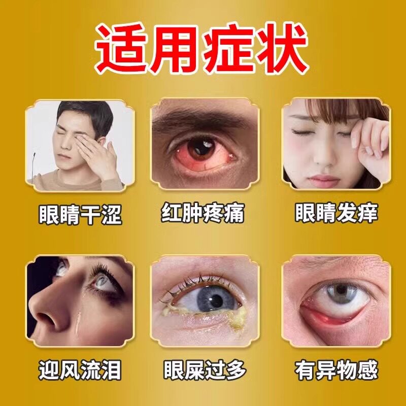 熊胆明目滴眼液结膜炎眼药水角膜炎滴眼液眼睛干涩疲劳模糊流眼泪
