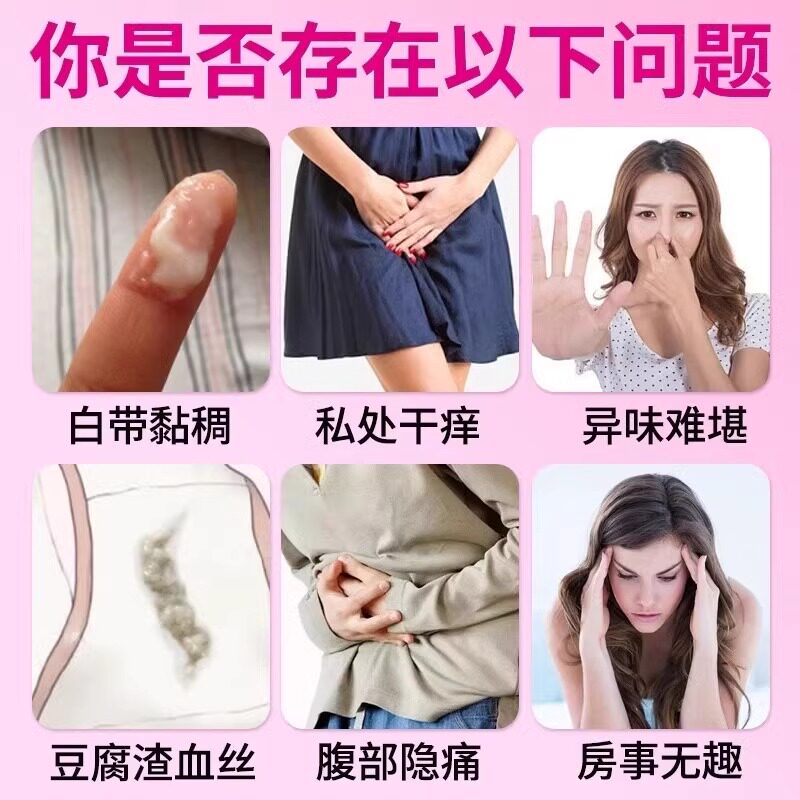 妇科外阴瘙痒专用止痒霉菌性阴道炎症私处瘙痒红肿抑菌消炎正品药