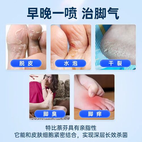 治脚气专用药水泡脱皮止痒烂脚丫痒脚趾缝糜烂型治疗真菌感染 - 图2
