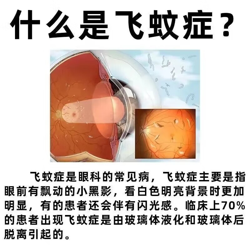 明目地黄丸官方旗舰店眼睛模糊看不清吃什么药飞蚊症眼前黑影飘动