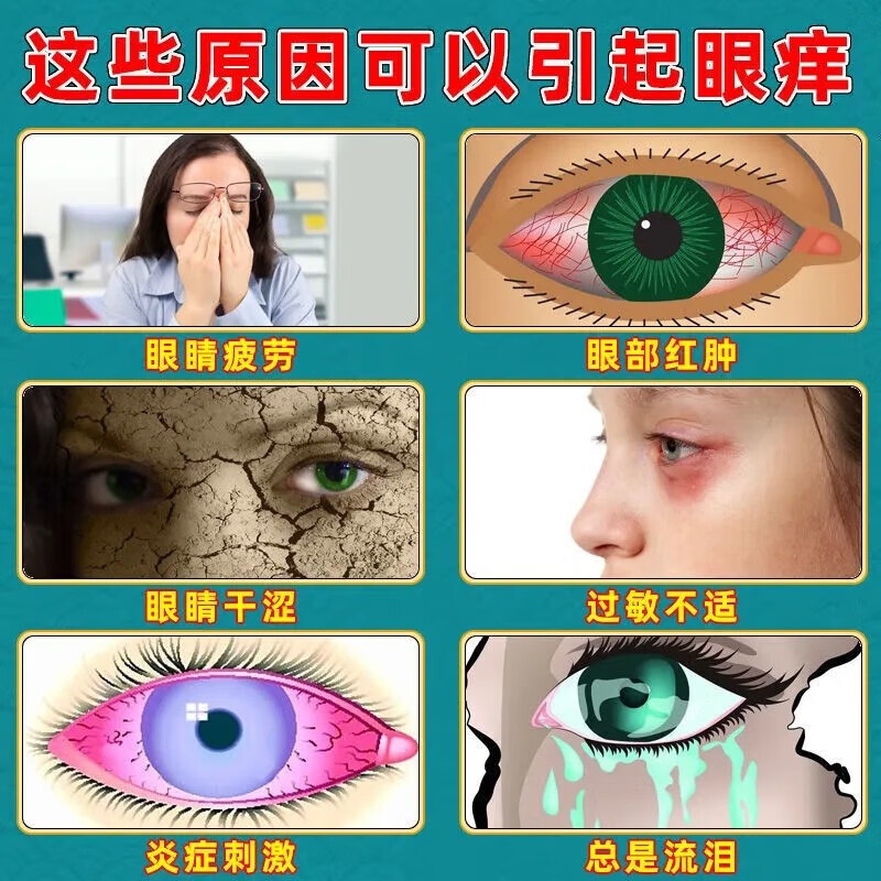 眼睛痒眼药水干涩发痒疲劳模糊越揉越痒杀充血去红血丝止痒消炎菌
