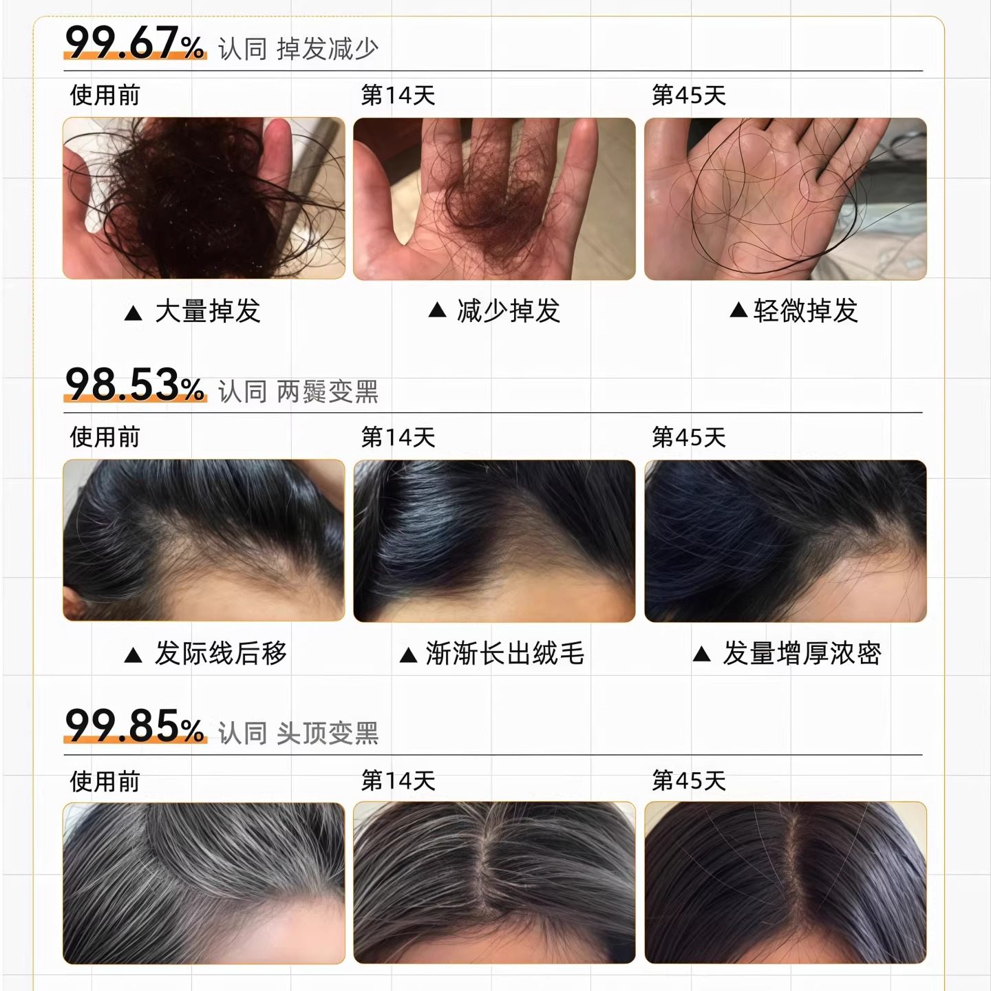 艾弗维生素B族乌发素白发脱发生物素黑发养发男女通用官方正品店,淘宝优惠券,粉丝福利购,淘宝优惠卷