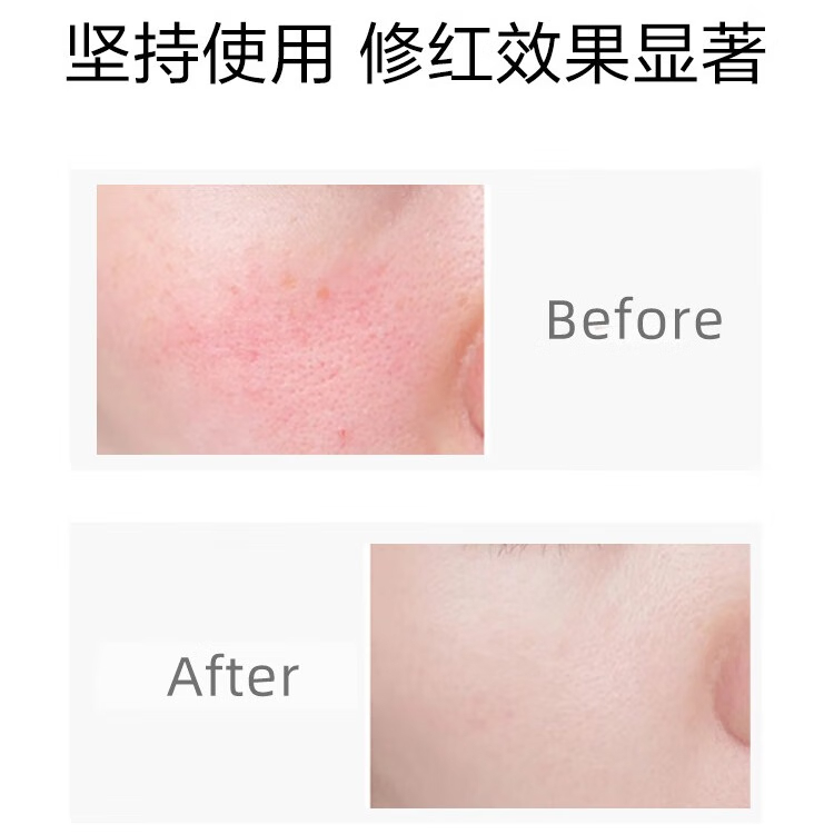 薇诺娜修红舒缓安肤乳敏感肌修护乳液weinuoma官网官方旗舰店正品