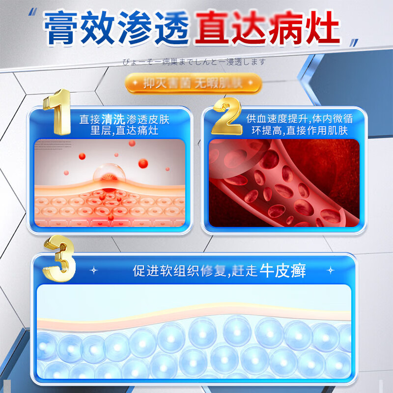 牛皮癣脚气藓贴膏软头皮手足银屑病皮肤止痒湿疹脚臭真菌凝胶-图2