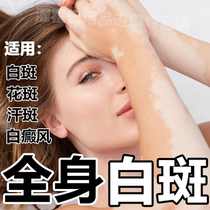 White Zebra Ben Cream Body Skin White Spot Flawless Cream White skin full body external cream