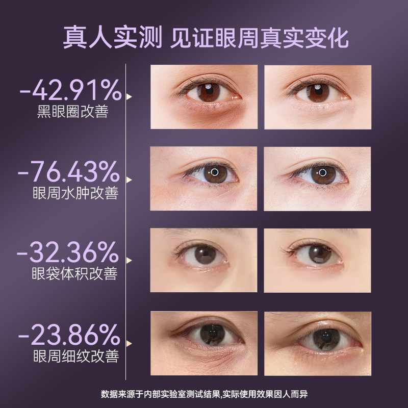 YD月牙美眼仪黑眼圈眼袋眼纹眼部提拉紧致热敷红蓝光微电流美容仪,淘宝优惠券,粉丝福利购,淘宝优惠卷