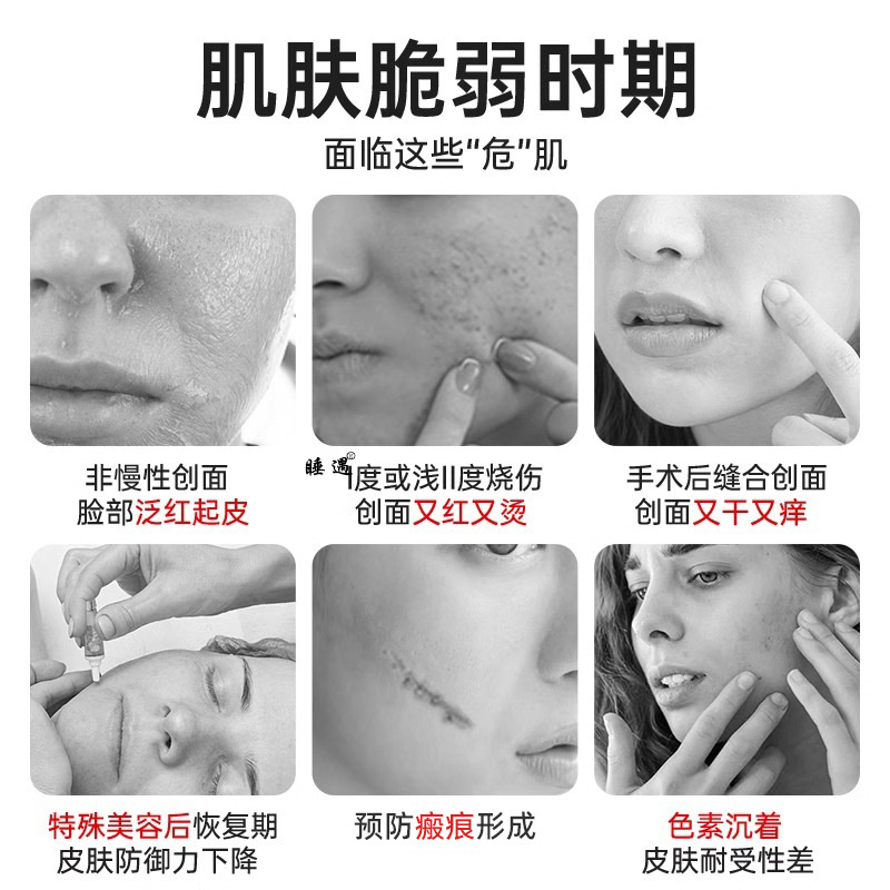 法兰度医用重组III型人源化胶原蛋白凝胶皮肤表皮伤口护理瘢痕