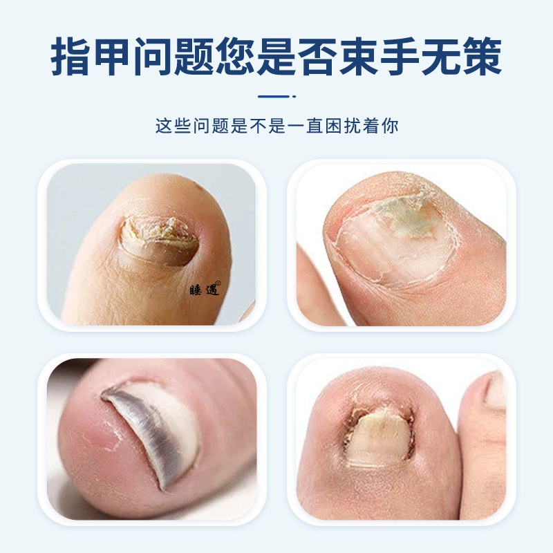 白云山花城灰甲护理液足部护理增厚亮甲软甲灰指甲护理液家用