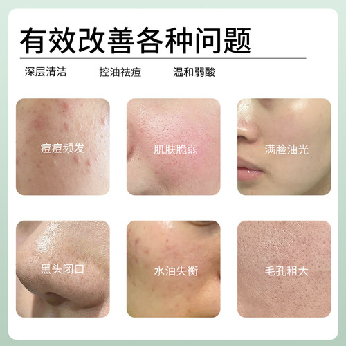 UIR复活草控油净痘洁面乳温和氨基酸洗面奶祛痘清洁男女旗舰店 - 图0