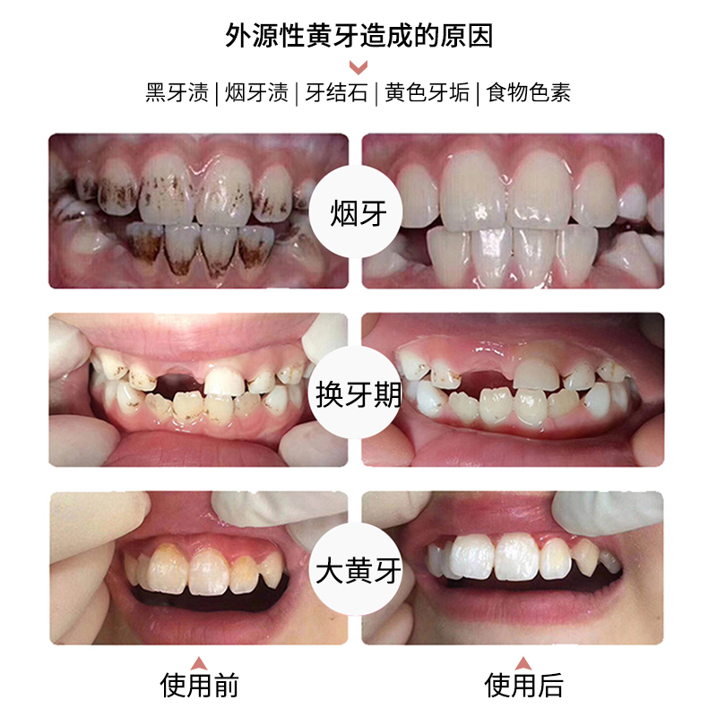 WILD/怀尔德进口牙膏抛光亮白去牙烟渍去黄深层清洁粉管