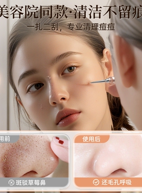 粉刺针套装清洁工具|千人加购