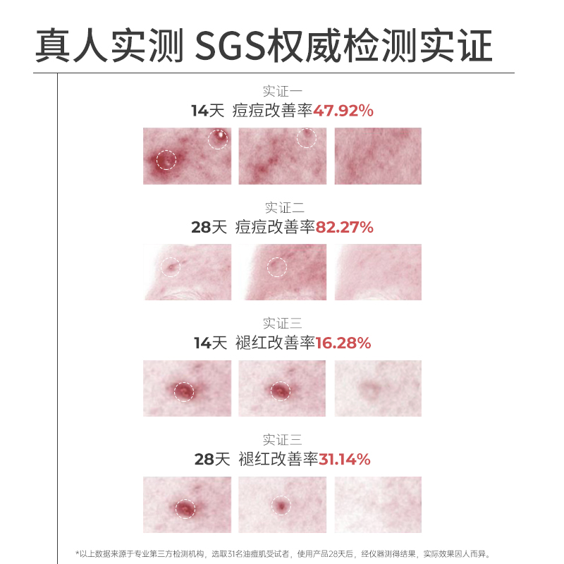 【舒蕾旗下】净豆去粉刺闭口淡化祛痘精华凝露熬夜上火快速瘪痘