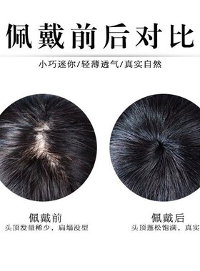 新品假发女头顶遮白发假发片真发头顶补发片女一片式轻.薄透气补