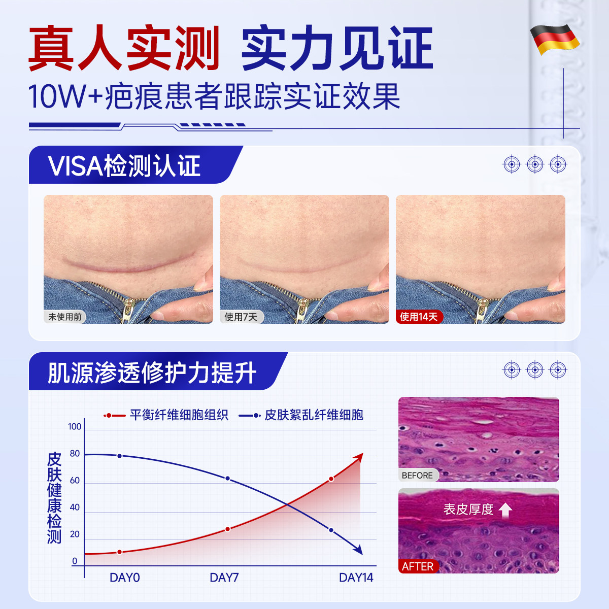 疤痕贴医用剖腹产术后伤口防水隐形甲状腺除凸减张硅酮凝胶祛疤贴
