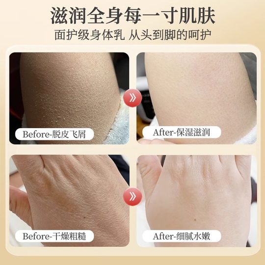 Pechoin body lotion anti-itch body lotion moisturizing and moisturizing