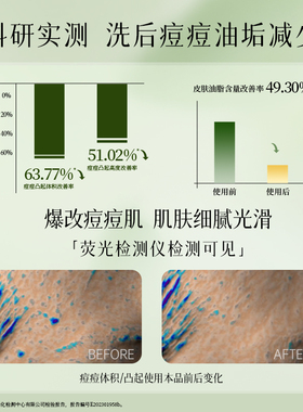 馥珮洗面奶控油祛痘补水保湿清洁毛孔男女士洁面乳官方旗舰店正品